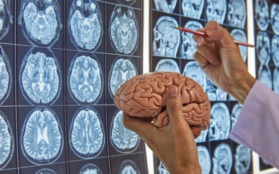 Mano in camice bianco tiene un modello di cervello; sullo sfondo griglia di MRI cerebrali; altra mano indica una scansione con penna rossa.Modello anatomico di cervello umano tenuto in mano davanti a una parete di risonanze magnetiche del cranio