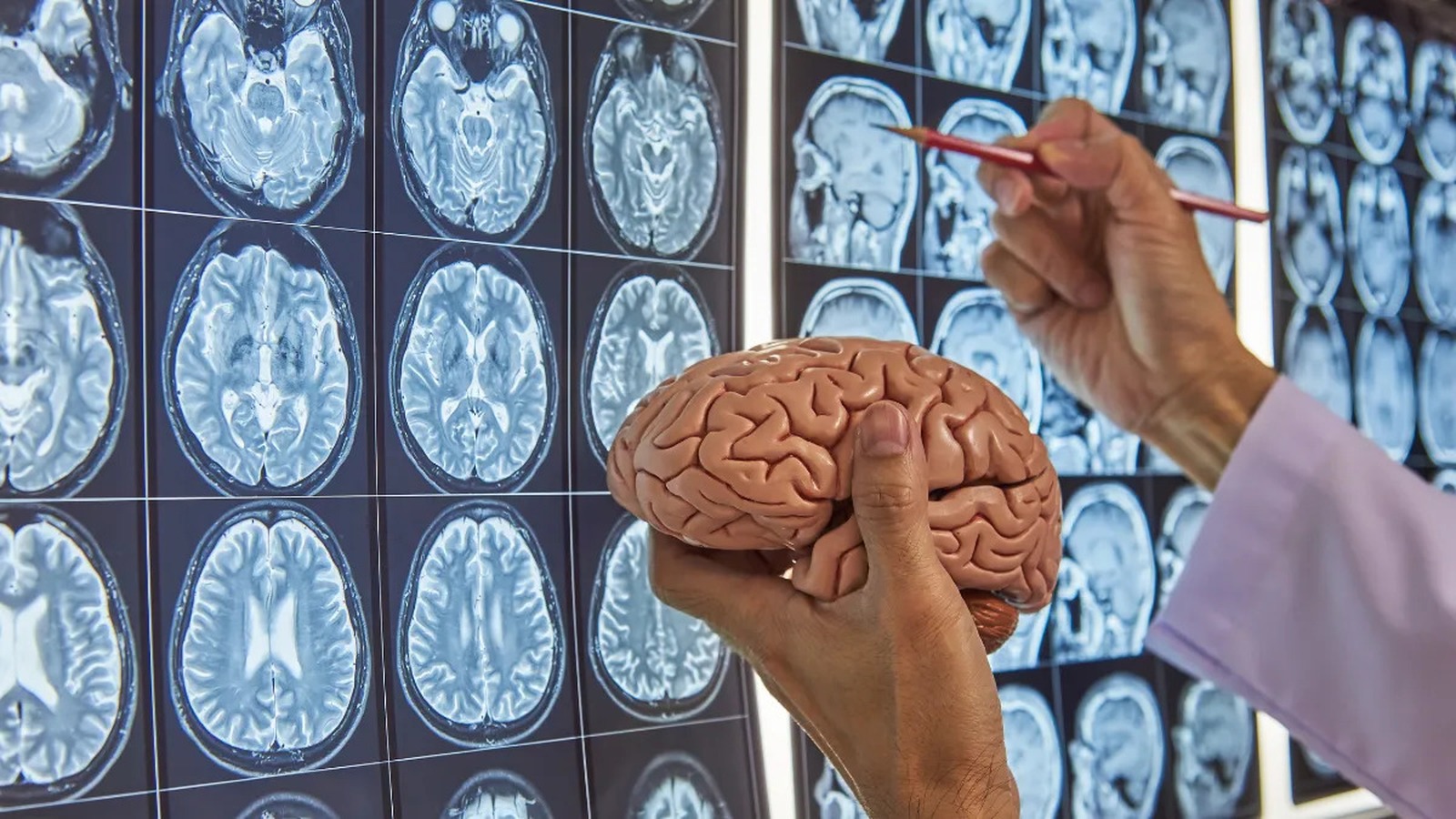 Mano in camice bianco tiene un modello di cervello; sullo sfondo griglia di MRI cerebrali; altra mano indica una scansione con penna rossa.Modello anatomico di cervello umano tenuto in mano davanti a una parete di risonanze magnetiche del cranio