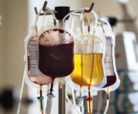 Sacche di componenti del sangue separati in una sala trasfusionale ospedaliera
