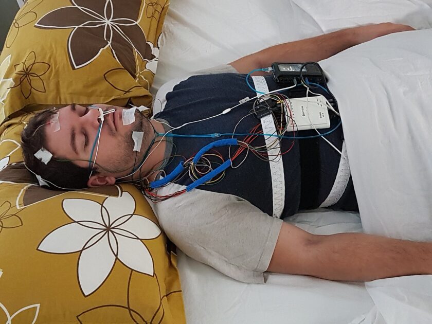 Uomo a letto con gli elettrodi e i sensori della polisonnografia per lo studio del sonno